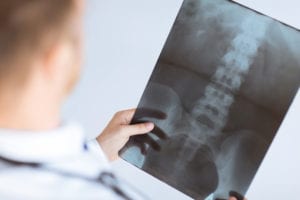 spinal_cord_injuries